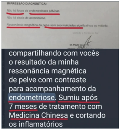 Depoimento sobre endometriose tratada com Dietoterapia Chinesa
