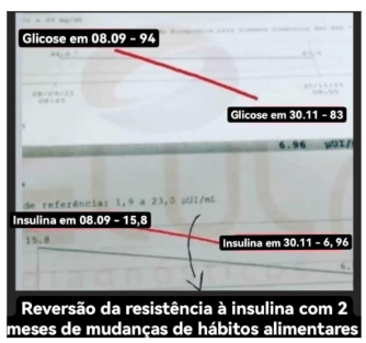 Depoimento sobre reversão da resistência insulínica em 2 meses com Dietoterapia Chinesa